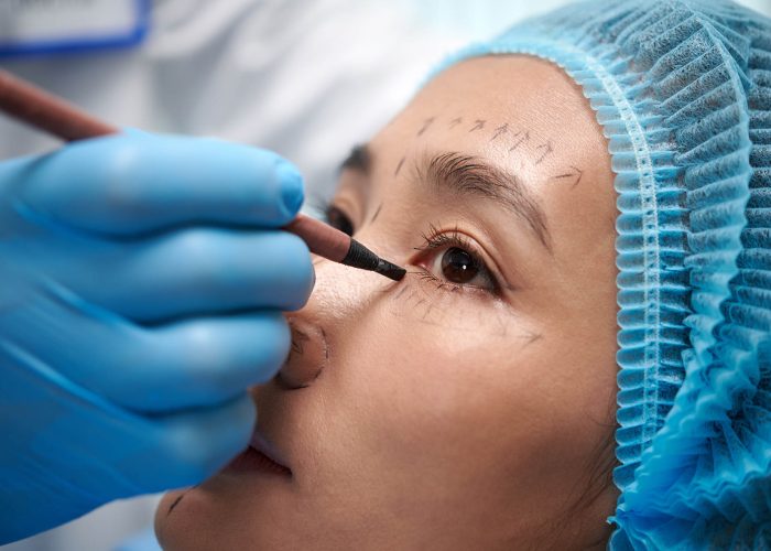 Closeup image of young woman getting face marked before blepharoplasty